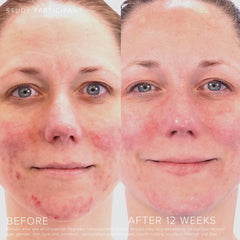 Rodan + Fields creamy texture on fingertip demonstrating smooth application and moisture benefit