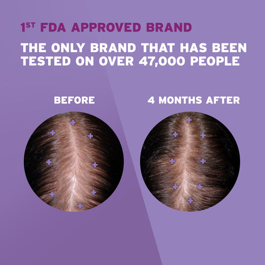 Rogaine 2% minoxidil unscented solution close-up texture for easy scalp absorption benefit