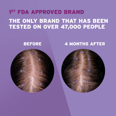 Rogaine 2% minoxidil unscented solution close-up texture for easy scalp absorption benefit