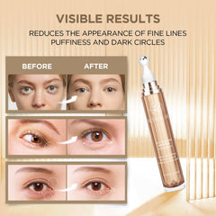 RONKIE eye cream held in hand for scale showing compact 15ML travel-friendly benefit