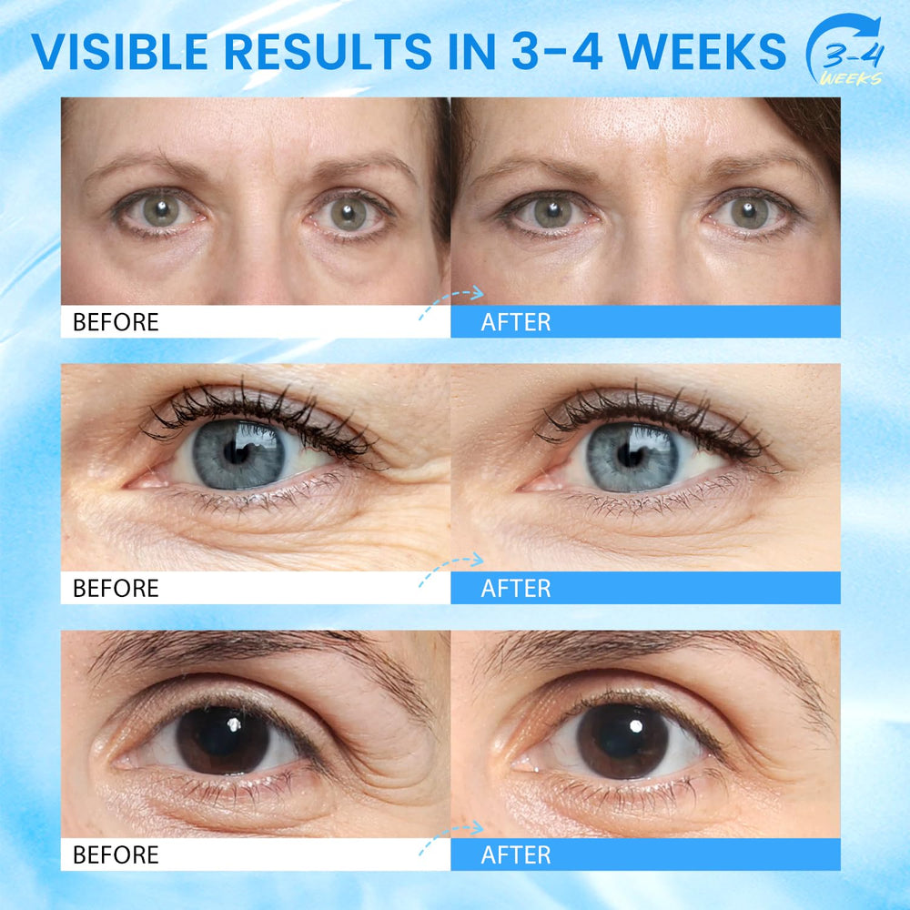 RONKIE eye stick in hand demonstrating easy twist-up application benefit