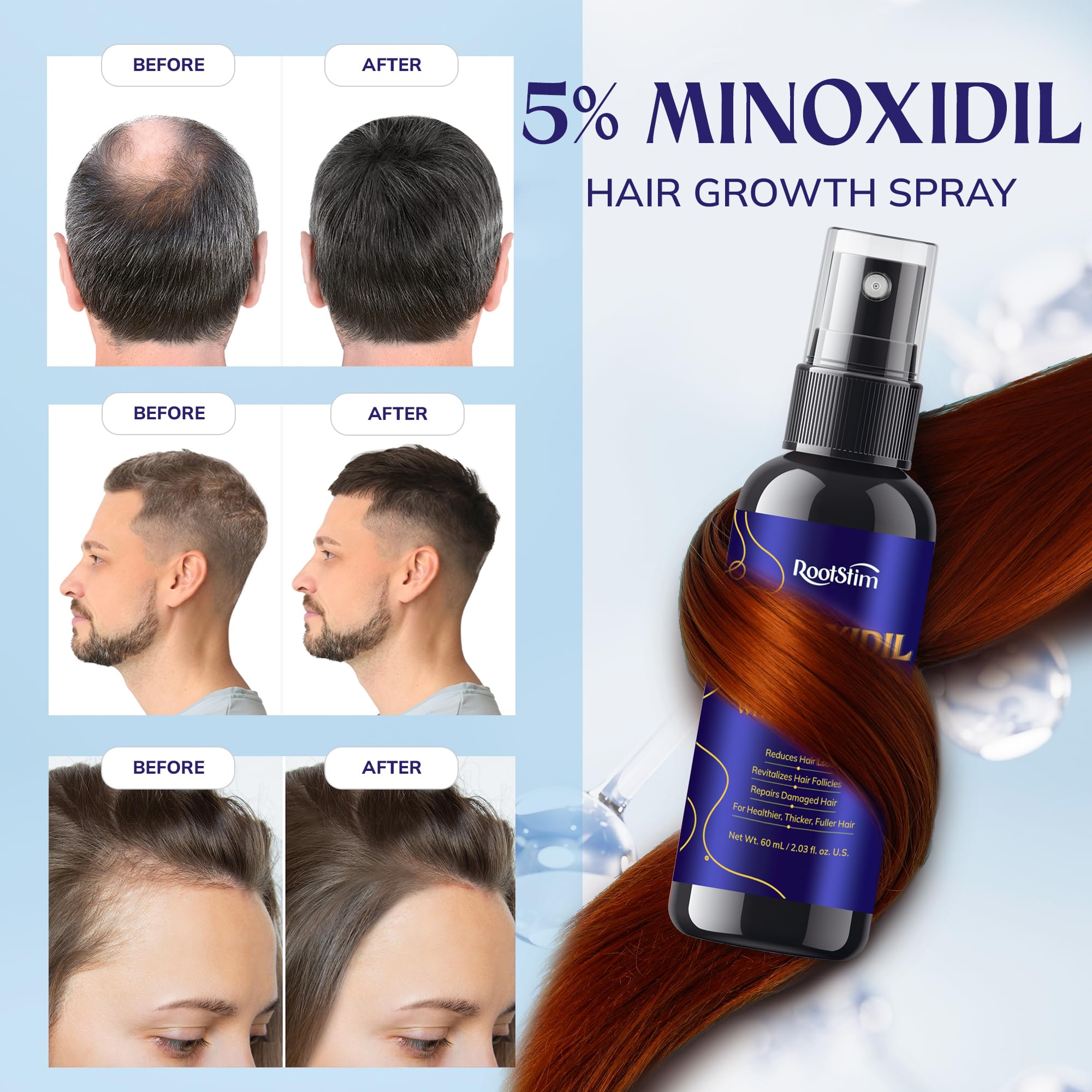 RootStim applied to scalp at thinning crown to support thicker looking hair