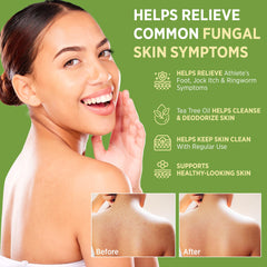 Roycederm ingredient label highlighting clotrimazole 1% benefit