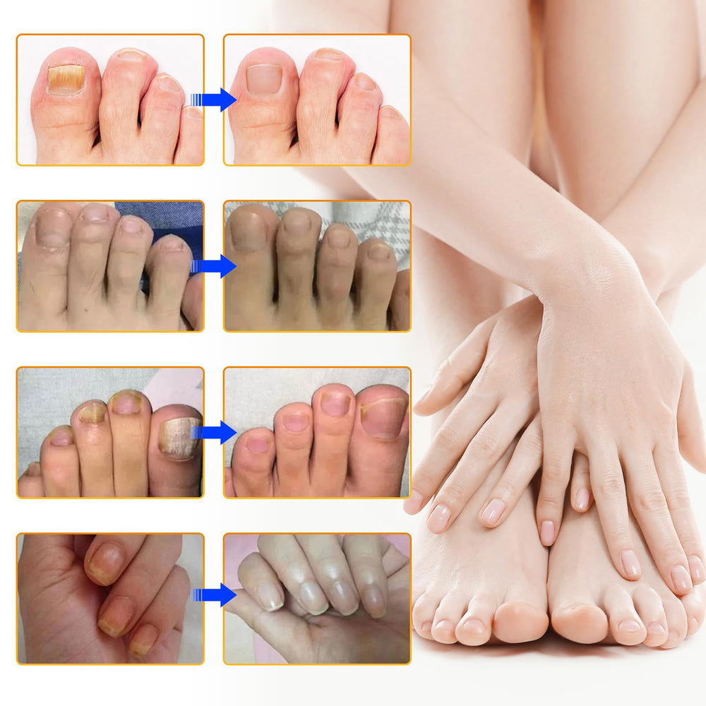 Ruduwu patch worn on foot in bed setting showing discreet nighttime use and convenience
