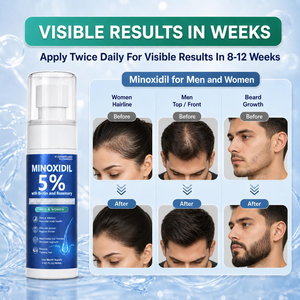 Rylx being applied to scalp area illustrating targeted topical treatment use