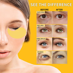 rywixm model applying patch under eye demonstrating de-puffing and even coverage