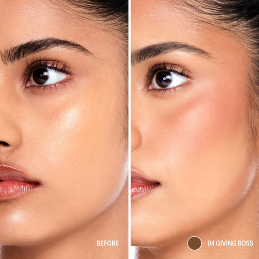 Sacheu applicator tip close-up demonstrating precise placement for controlled sculpting