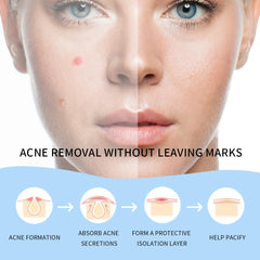 Safirst peeling off patch detail showing easy removal and no-residue benefit