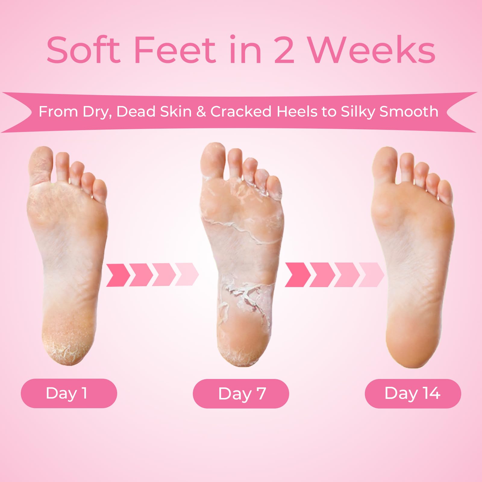 SAISZE booties worn during treatment demonstrating easy application benefit