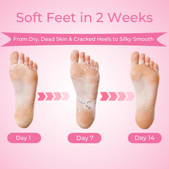 SAISZE booties worn during treatment demonstrating easy application benefit