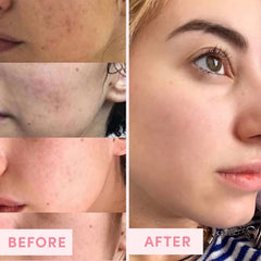 Rinsing Sand & Sky mask from skin, shows gentle removal and clean-feeling benefit
