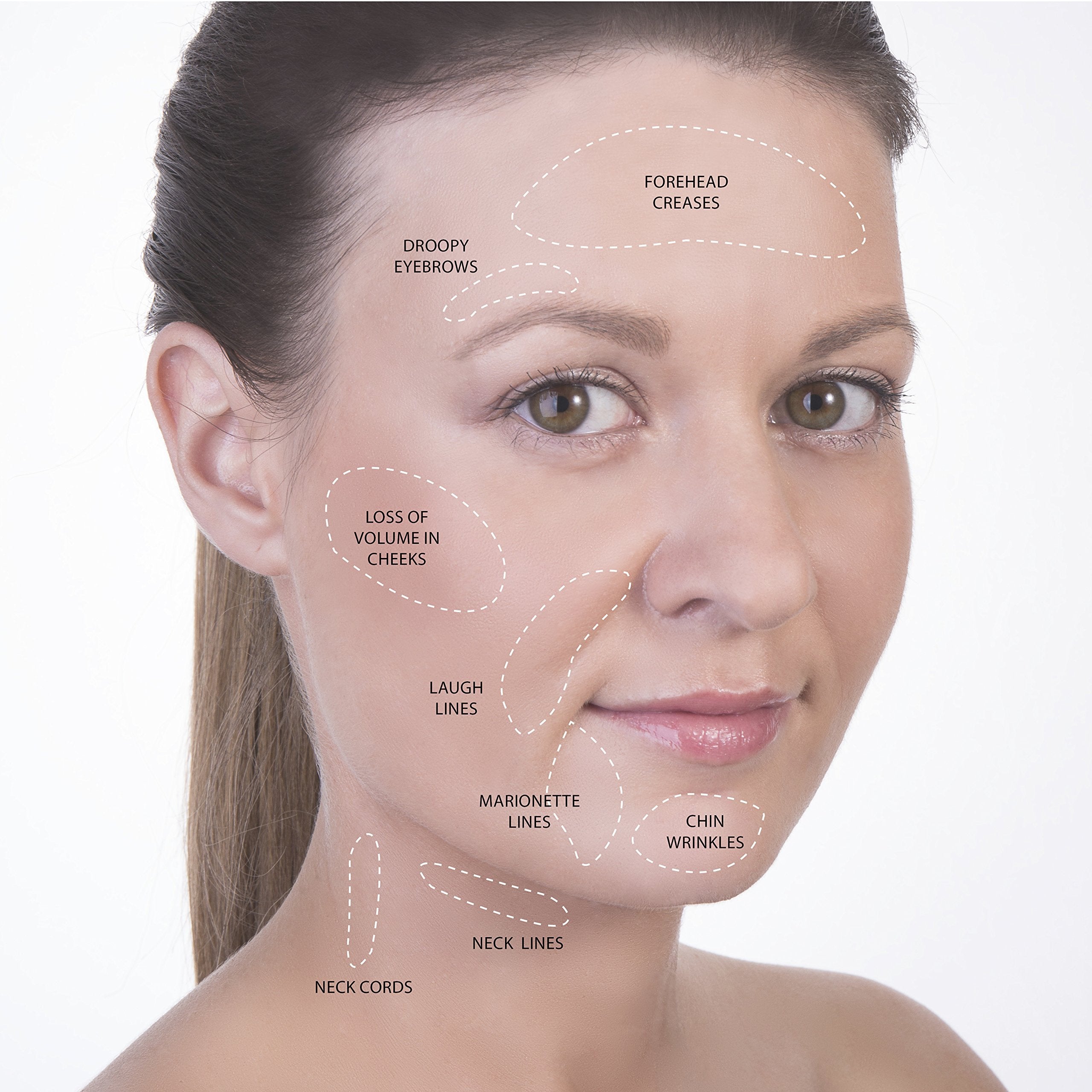 SanDine Silky Skin close-up of silicone texture highlighting gentle contact