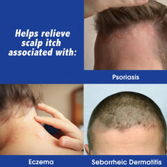 Drop of Scalpicin liquid texture demonstrating lightweight, non-greasy feel