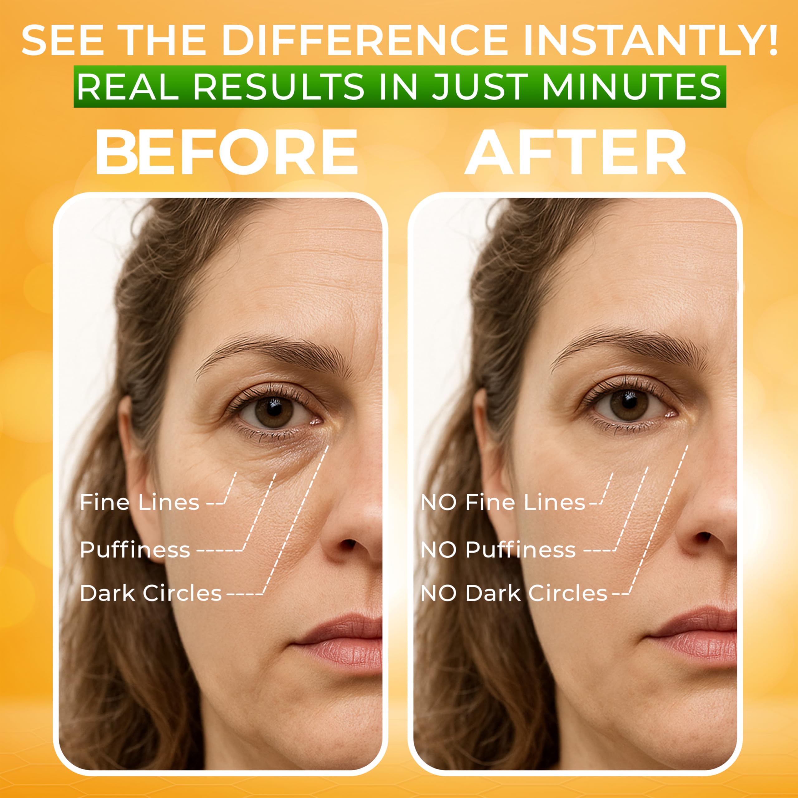 SEAMANTIKA application demonstration patting under-eye area to reduce puffiness fast