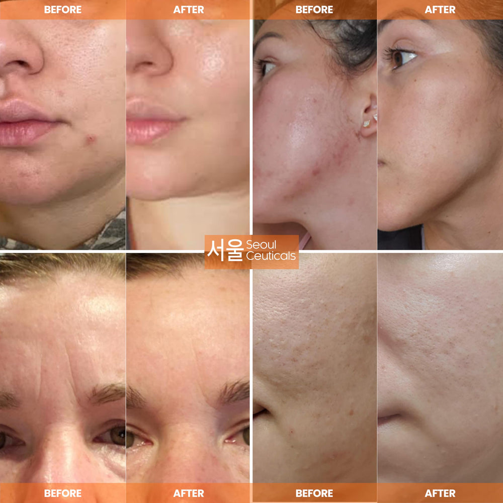 SeoulCeuticals product label closeup highlighting ingredient benefits