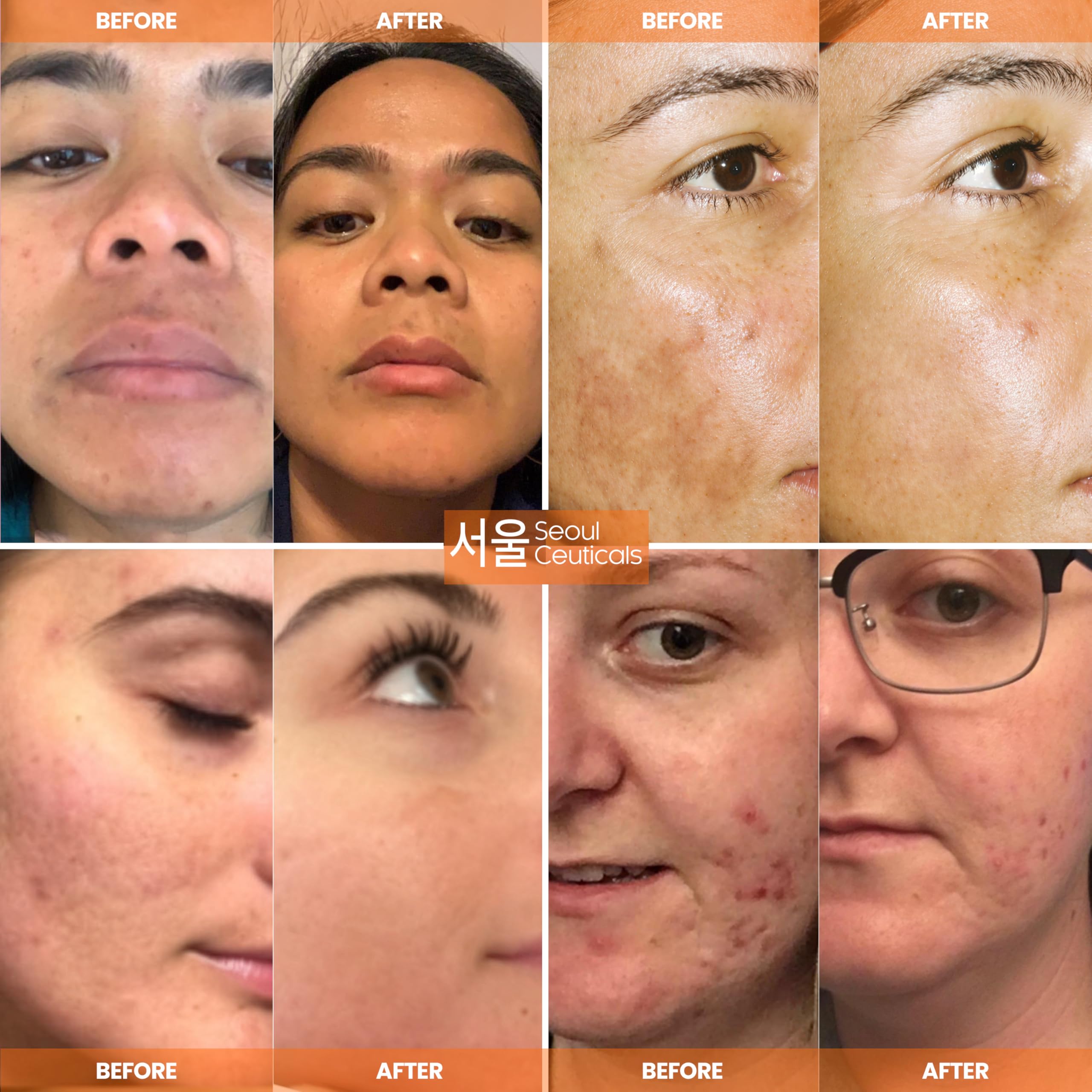 SeoulCeuticals serum texture on skin to show lightweight hydration benefit