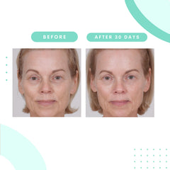 Serious Skincare ingredients aloe and chamomile calming the skin