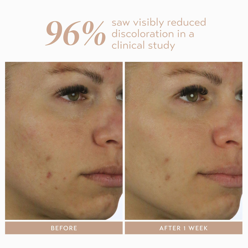 SHANI DARDEN model applying serum to cheeks showing easy layering
