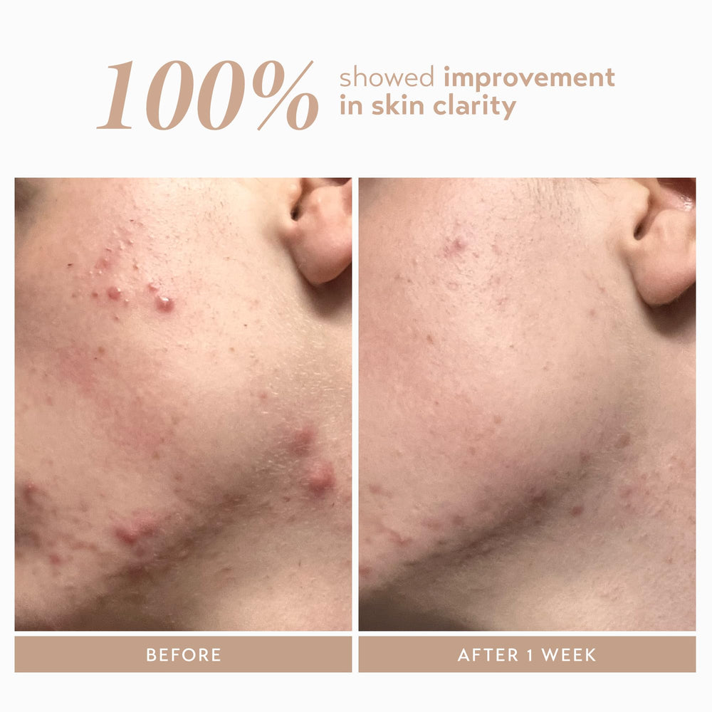 SHANI DARDEN serum spread on skin demonstrating smooth absorbency