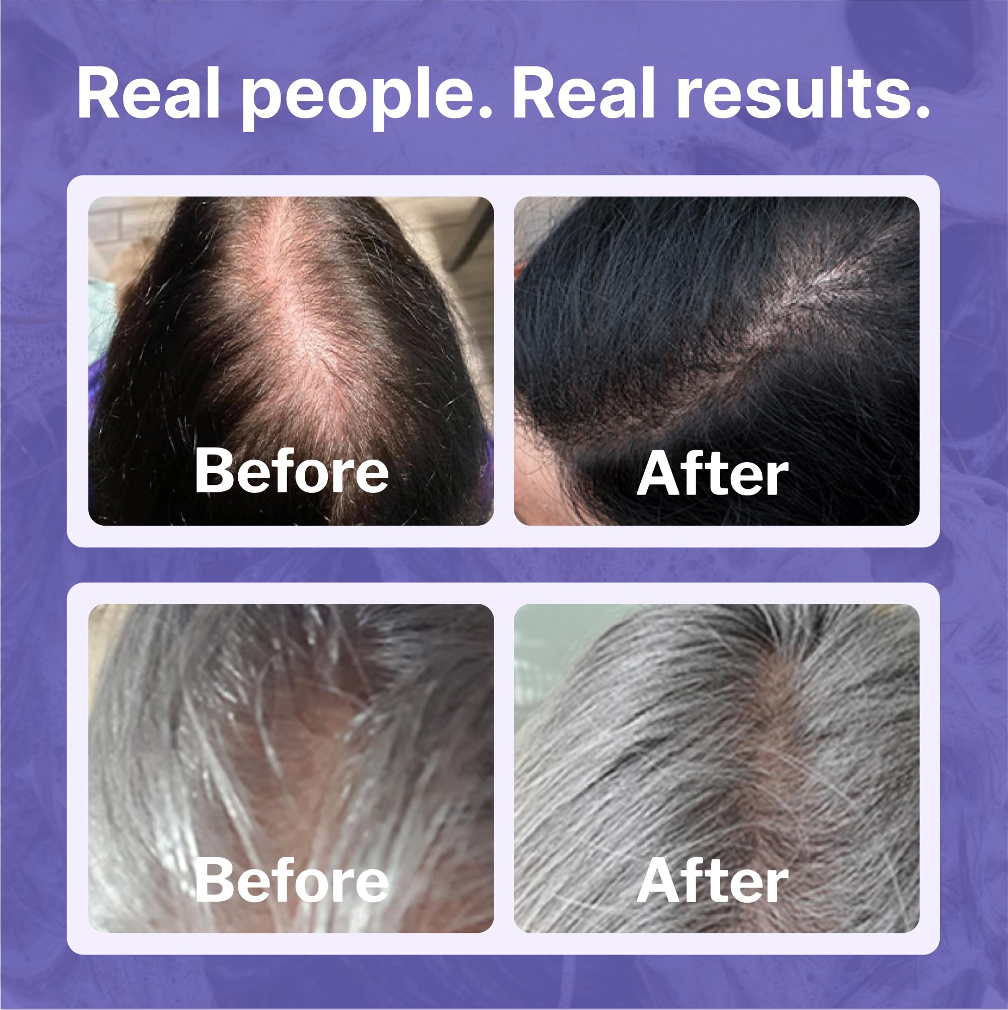 Shapiro MD conditioner cream texture demonstrating hydration and smoothness