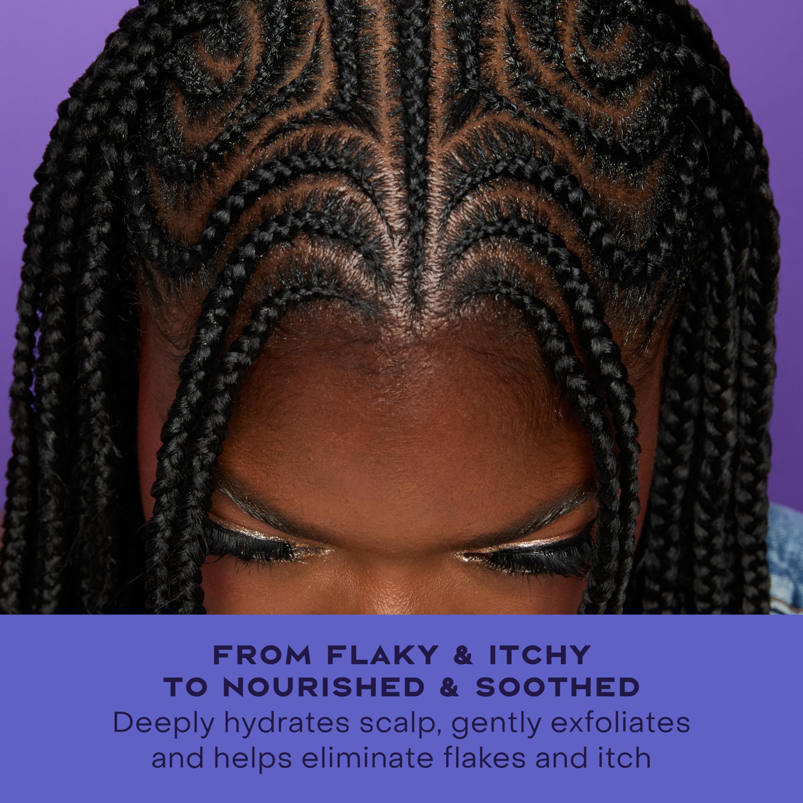 Shea Moisture before and after scalp visual showing reduced visible flakes