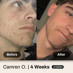 Male model using Shield face wash illustrating easy daily 30-second routine