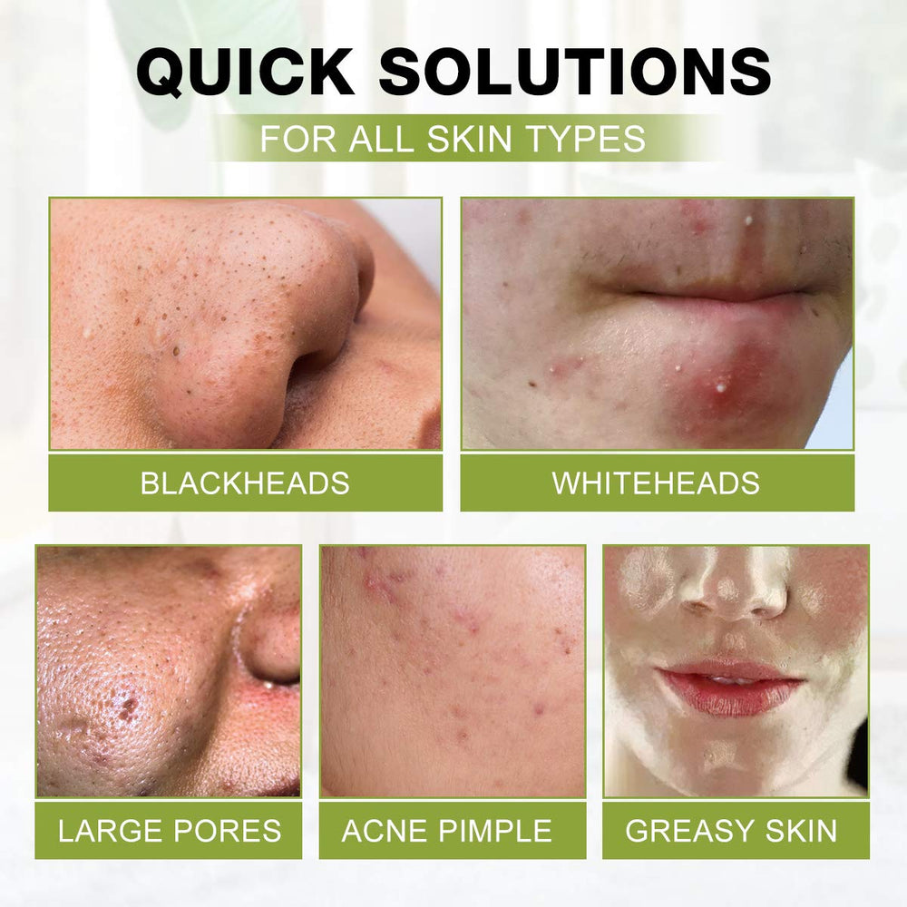 SHVYOG mask texture spread on skin showing consistency and coverage