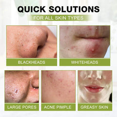 SHVYOG mask texture spread on skin showing consistency and coverage