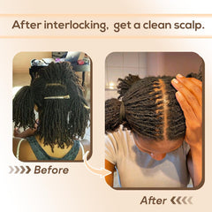 Siphis detail of loop mechanism showing secure hair pull-through advantage