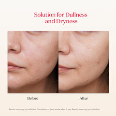 Remaining SK‑II essence being massaged into skin to reveal lasting moisture benefit
