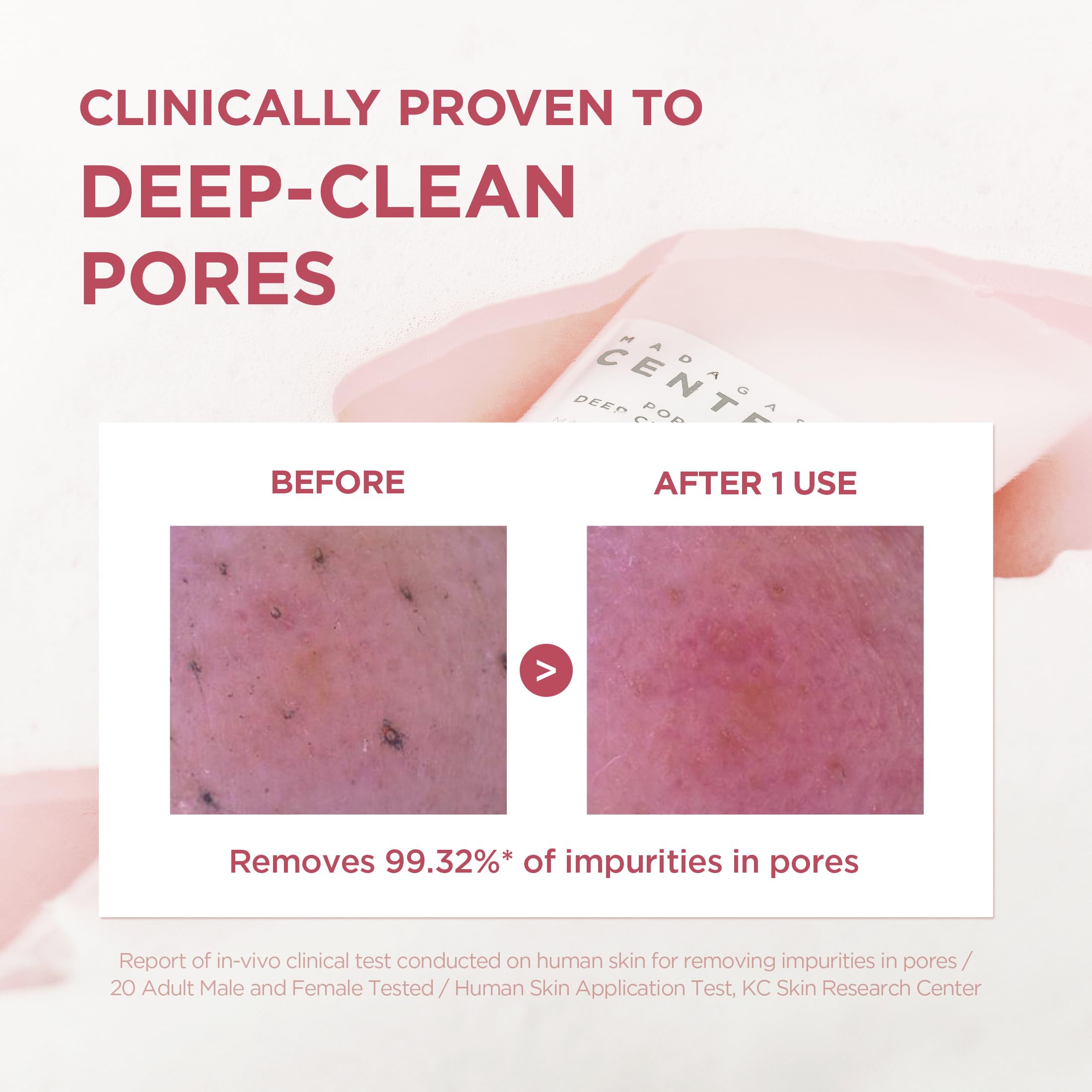 SKIN1004 close-up foam texture highlighting rich dense lather for thorough cleansing