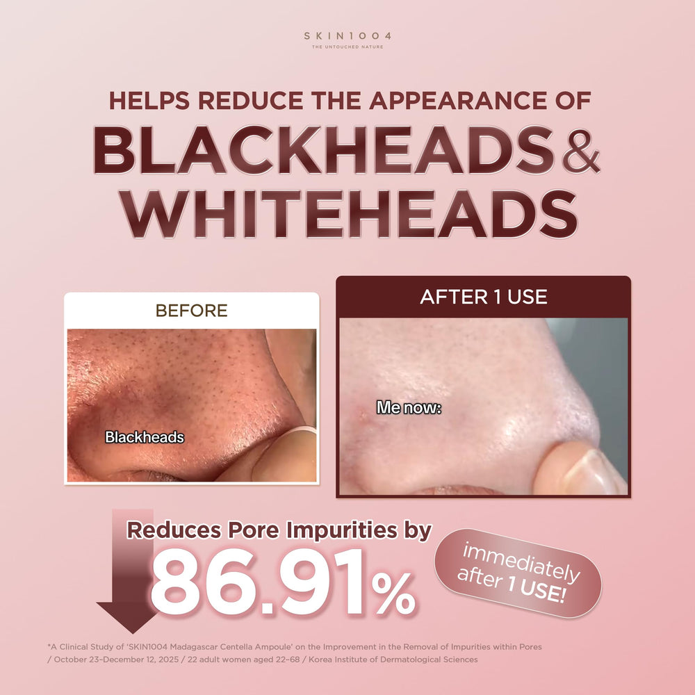 SKIN1004 applying clay stick to cheek demonstrating targeted pore care benefit