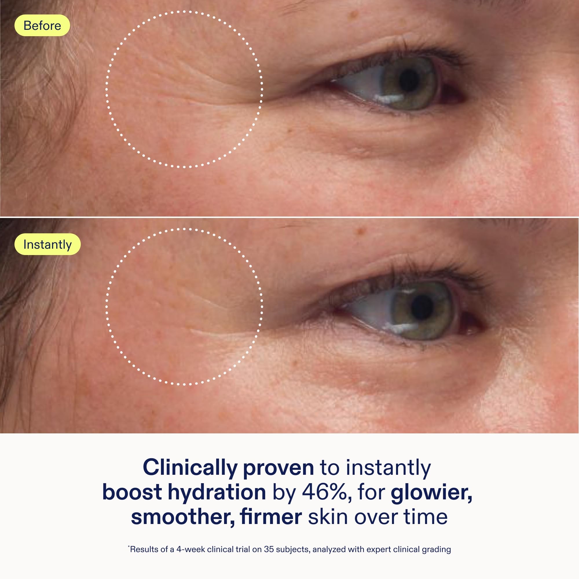 Skinfix applying cream from jar onto hand for instant hydration