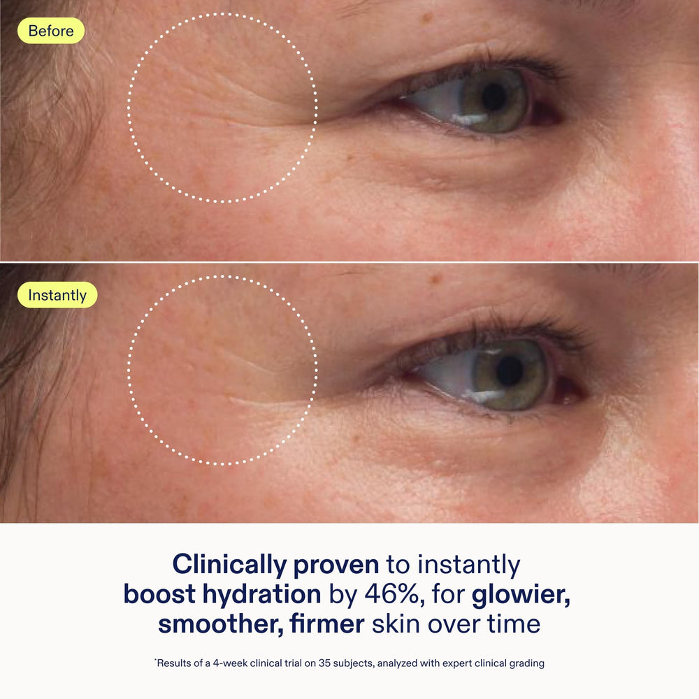 Skinfix applying cream from jar onto hand for instant hydration