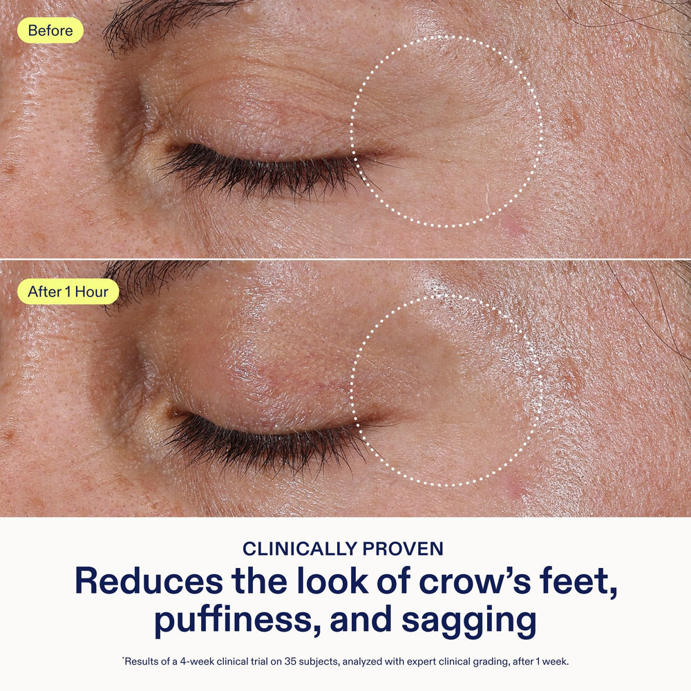 Skinfix jar label close-up highlighting ingredients and clean formulation benefits