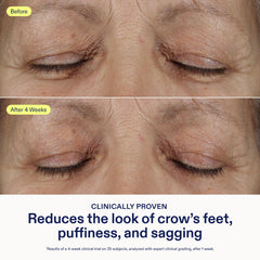 Skinfix cream on finger ready to apply, illustrating easy, precise application