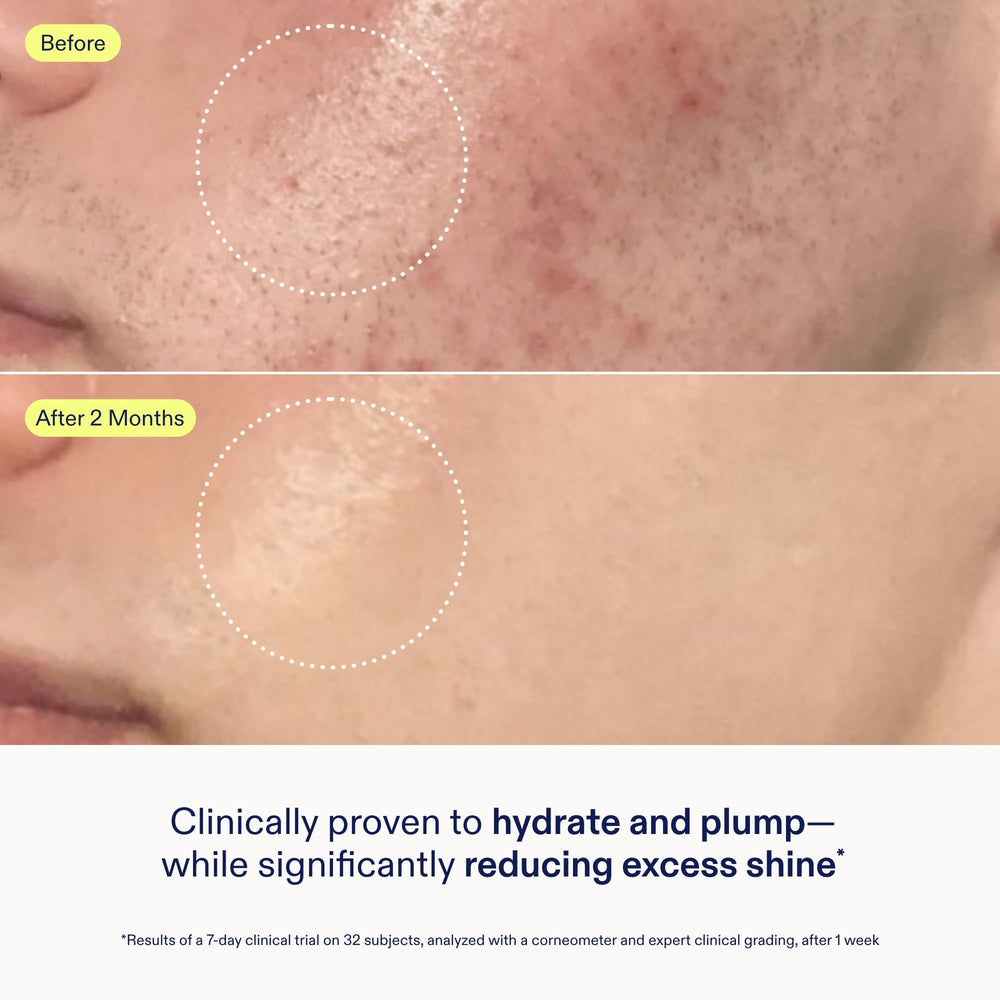Skinfix ingredient label showing B-L3 complex and clinical claims