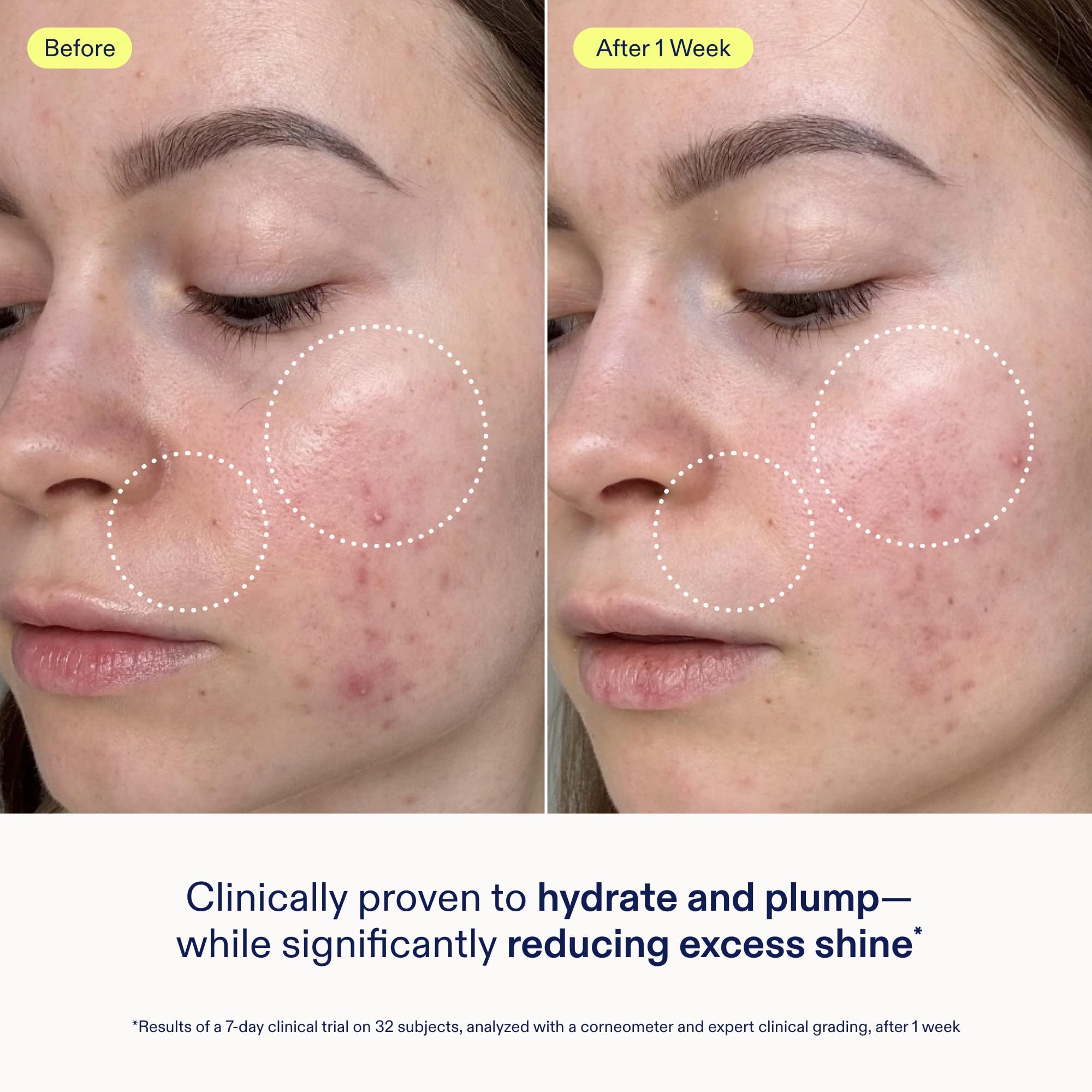 Skinfix pump dispensing gel cream for controlled, hygienic application