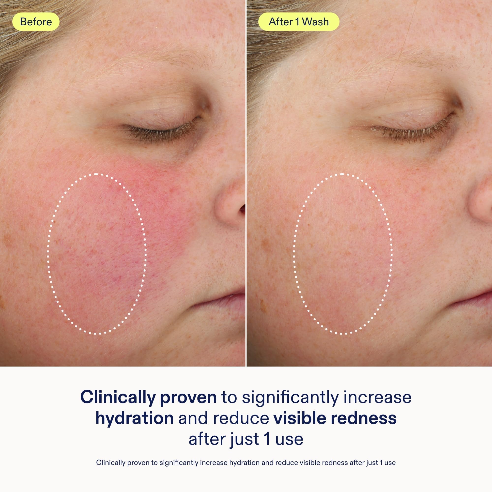Skinfix gel-to-foam texture close-up illustrating gentle cleansing