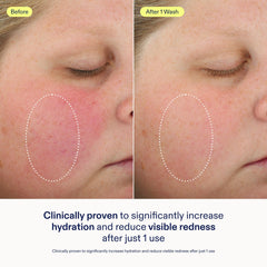 Skinfix gel-to-foam texture close-up illustrating gentle cleansing