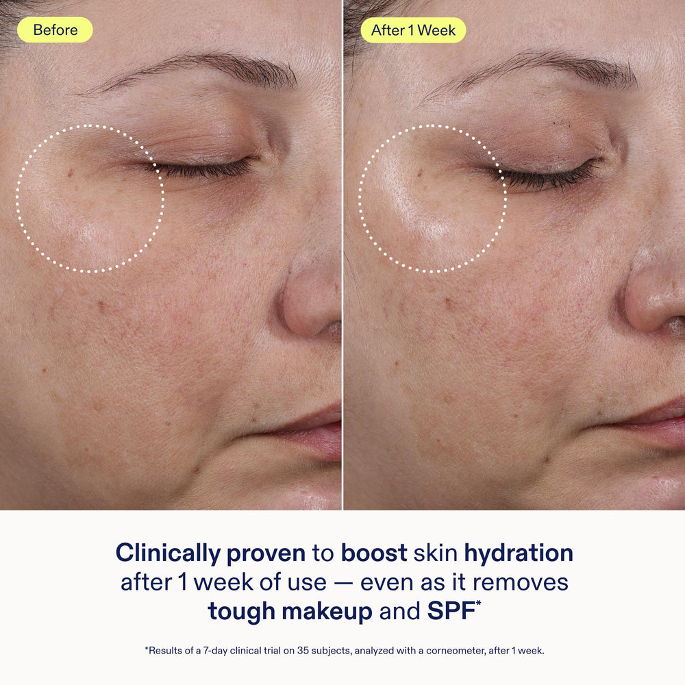 Skinfix gel cleanser on fingertip demonstrating easy dispensing and precise use