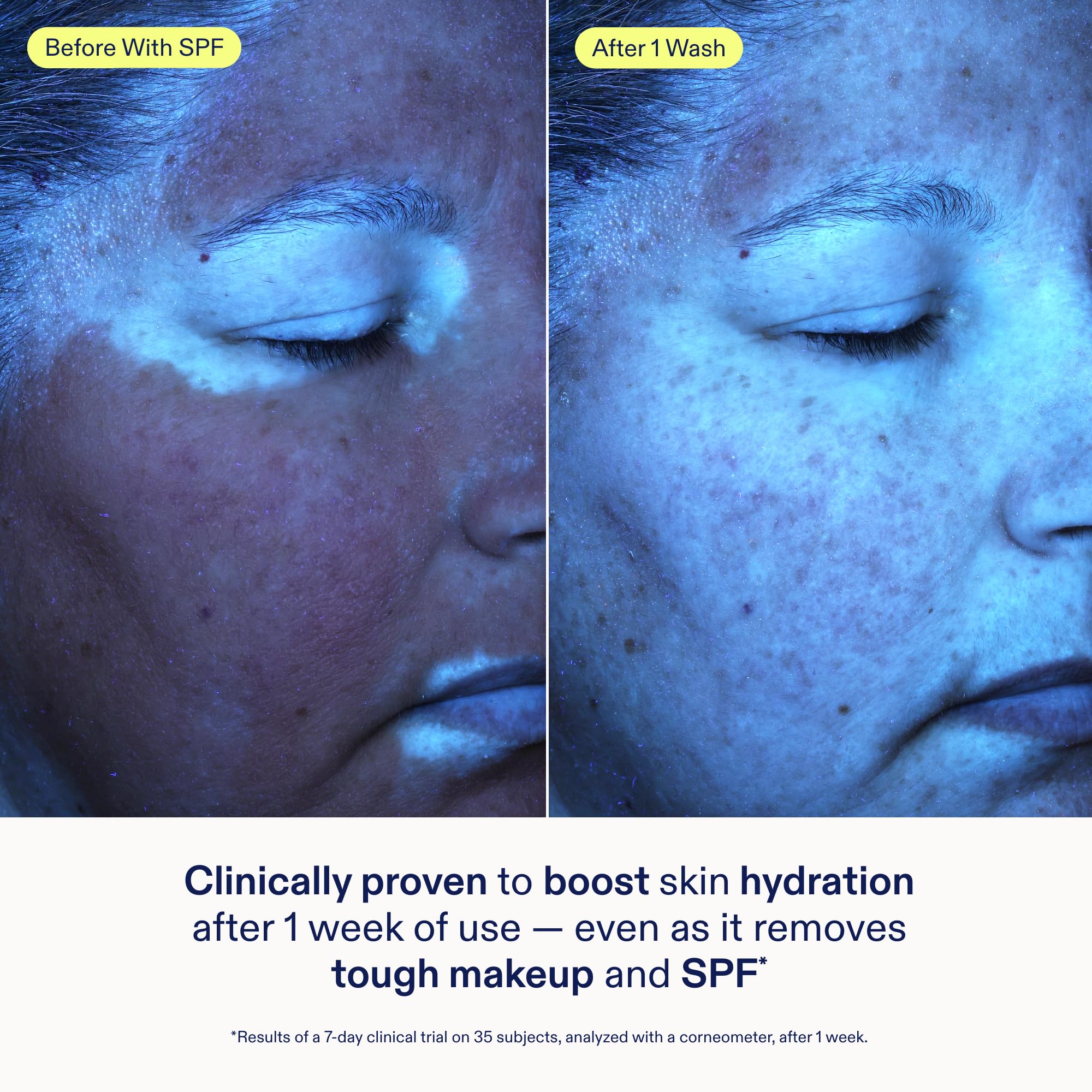 Skinfix gel cleanser texture close-up showing clear gel consistency and gentle feel