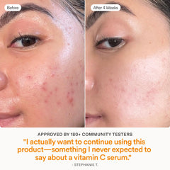 Skinfix ingredient visual with ferulic and vitamin C emphasizing potency
