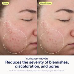 Skinfix cleanser texture lather close-up showing gentle foam and exfoliant action
