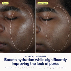 Skinfix ingredient label close-up showing active niacinamide benefits