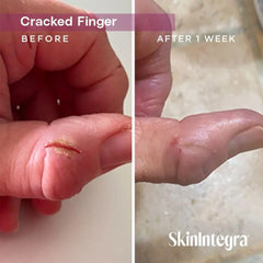 SkinIntegra tube beside scale indicating 3 oz size for accurate quantity comparison