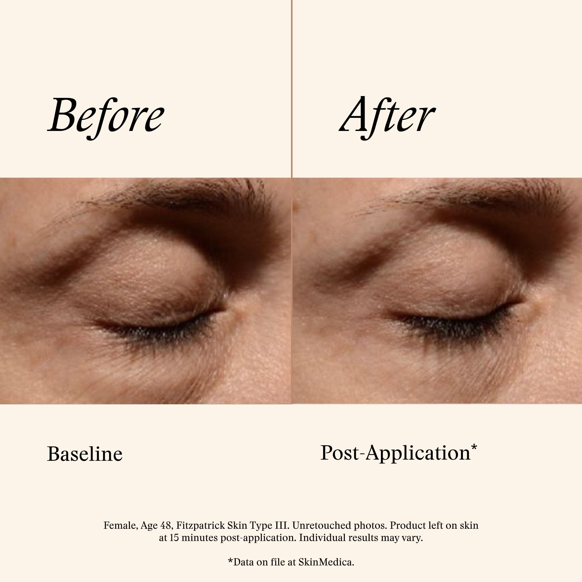 Applying SkinMedica eye cream under eye showing quick absorption benefit