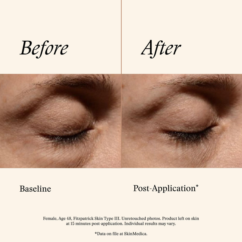 Applying SkinMedica eye cream under eye showing quick absorption benefit
