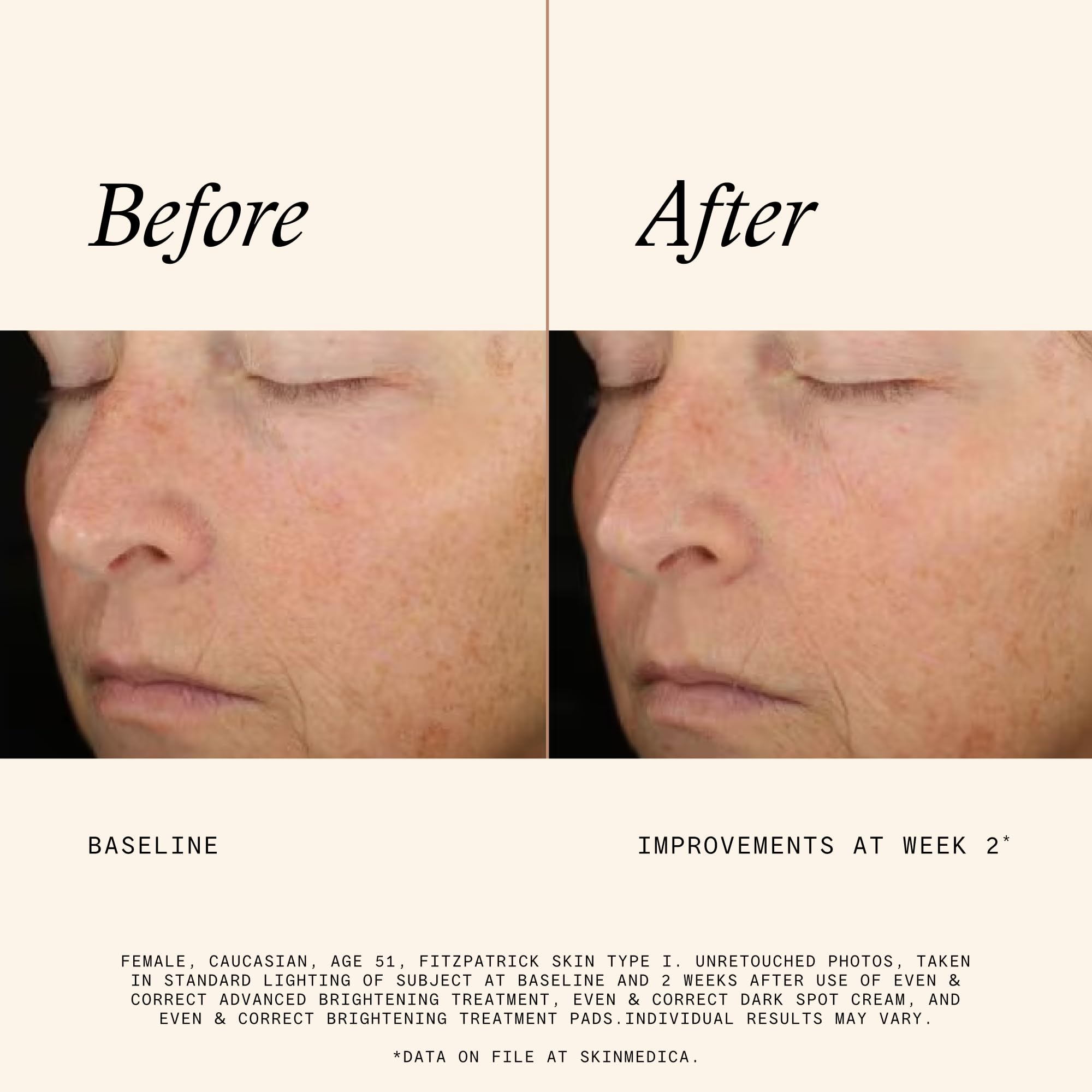 SkinMedica pad held in hand demonstrating easy application and controlled use