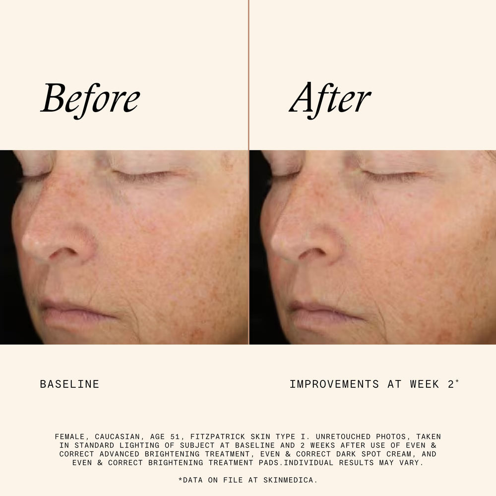 SkinMedica pad held in hand demonstrating easy application and controlled use